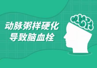 脑血栓的形成原因有哪些？常见于这4种情况