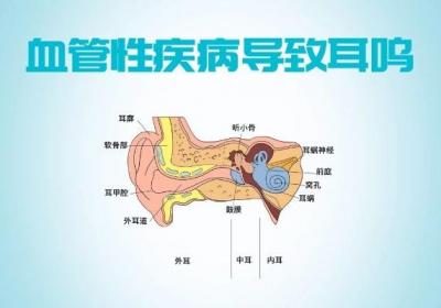 耳鸣是肾虚吗？引起耳鸣的因素有哪些？