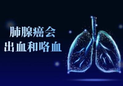 肺腺癌的症状及表现有哪些？常见的突出的症状有以下几种