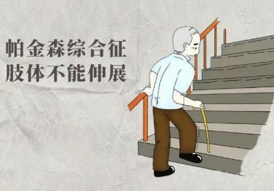 帕金森综合征的症状与表现是什么？可分为两大类