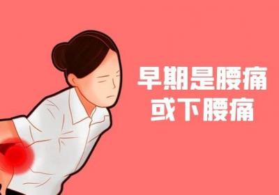 什么是强直性腰椎炎？强直性腰椎炎的症状有哪些？