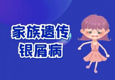 导致银屑病的原因是什么，这些你知道吗？