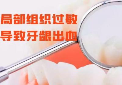 口腔小知识：牙龈出血的原因有以下几点