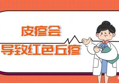 皮疹是什么原因引起的？皮疹的症状有哪些？