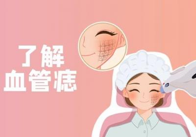 什么是血管痣？是需要治疗的疾病吗？