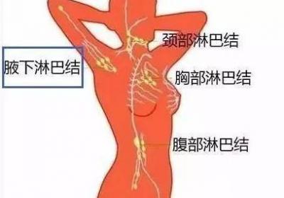 淋巴结肿大的原因有哪些？以及会对身体造成什么影响？
