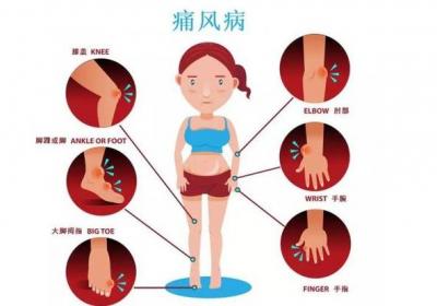 如何预防痛风石的发生？从而远离它带来的种种危害