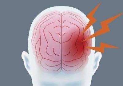 中医治疗脑出血的方法有哪些