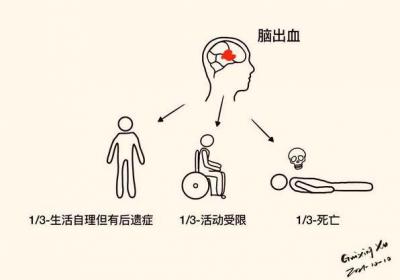 脑出血治疗的应急方法有哪些
