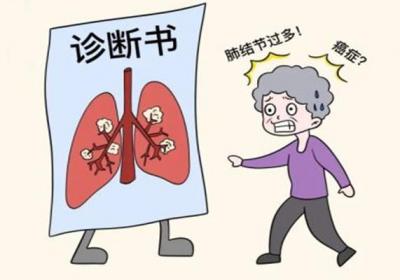 检查出肺结节，就意味着是肺癌早期吗？