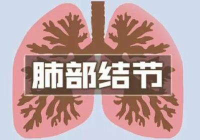 区分肺部结节是良性的还是恶性的方法