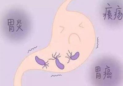 如何治疗吞酸？