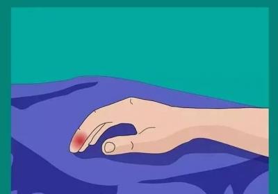 导致手指挛急的因素有哪些？