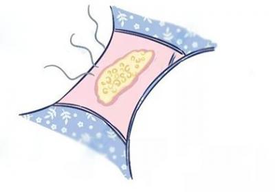 这5种妇科病会导致白带异味重
