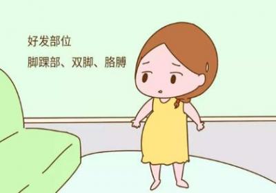 妊娠肿胀好发于哪些部位