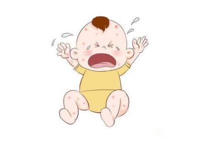 红疹为什么会出现在脸上？