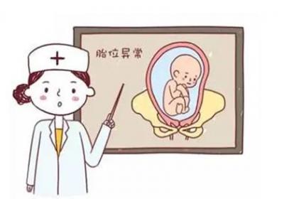 胎位不正一定要剖腹产吗