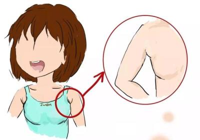 腋窝红肿的病因是什么？