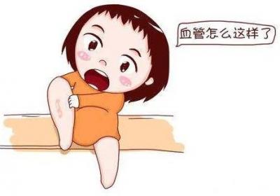 血栓性静脉炎早期症状有哪些？