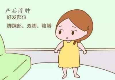产后浮肿的注意事项有哪些