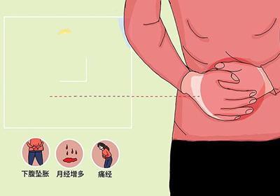 癥瘕是什么