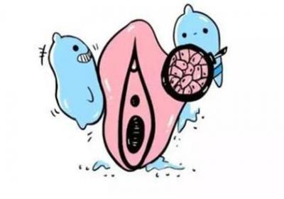 阴疮能自愈吗