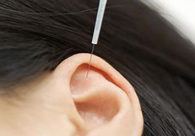 阴痛的其他疗法