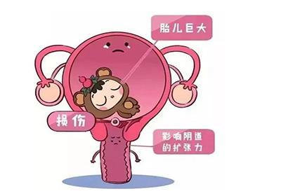 阴吹是怎么引起的