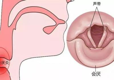 什么因素导致咽喉痛？