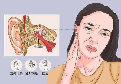 急性化脓性中耳炎的表现症状