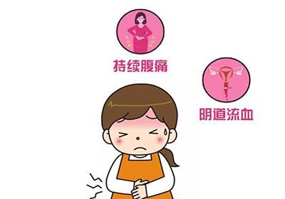 经期延长的鉴别诊断