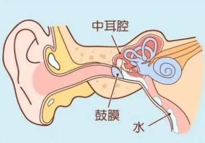 耳胀是什么原因造成的？