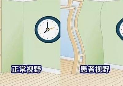 小儿青盲的饮食禁忌