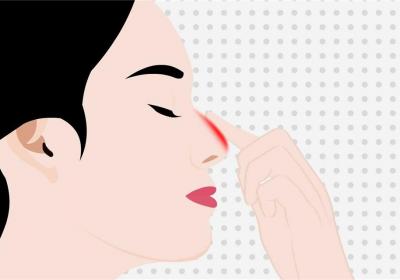 细数鼻痛相关疾病