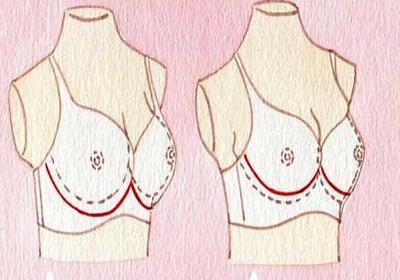 经前乳房胀痛要注意什么