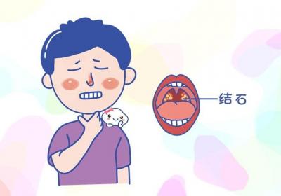 急性扁桃体炎如何治愈？