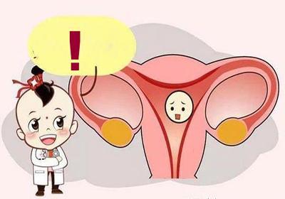 无排卵型功能性子宫出血是什么