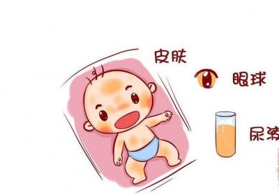 小儿发黄的危害