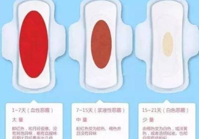 产后恶露的颜色