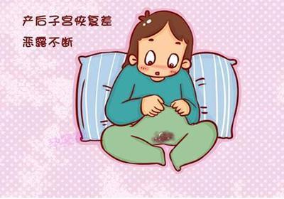 什么是产后恶露不绝